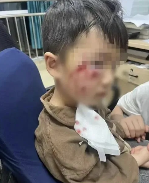 被瘋?cè)麤](méi)有“救命藥”，怎么辦？